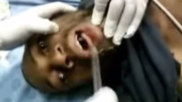 Imagem Vídeo: jovem engole aparelho celular e acaba em emergência de hospital
