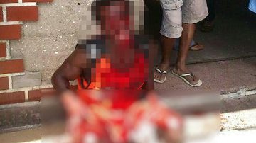 Imagem Vídeo: jovem acusado de estupro leva golpes de facão no rosto em Coité