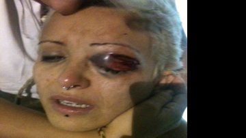 Imagem Atriz e namorada agredidas em galeria do Acbeu serão indenizadas em R$ 25 mil