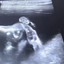 Médica veterinária viraliza ao compartilha vídeo de filhote lambendo a patinha durante ultrassom\u003B assista