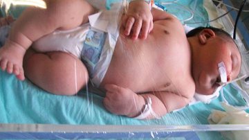 Imagem Bebê gigante nasce com quase 7 kg